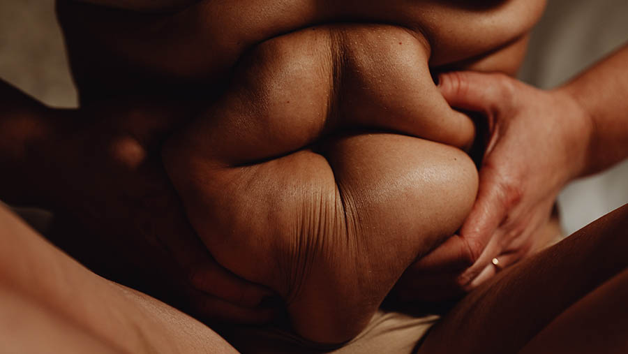 Ilustrasi obesitas. (Photo by Karolina Grabowska)