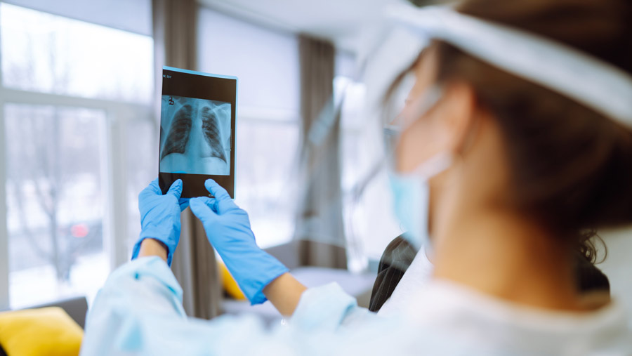 Seorang dokter wanita berkacamata dan sarung tangan pelindung membaca hasil X-Ray paru-paru