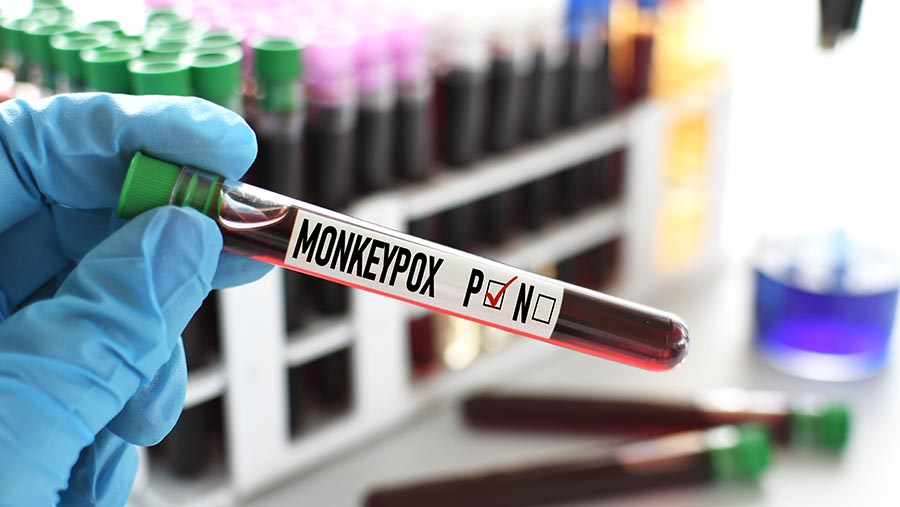 Seorang pekerja laboratorium medis memegang botol darah untuk menguji virus cacar monyet. (Envato/MargJohnsonVA)