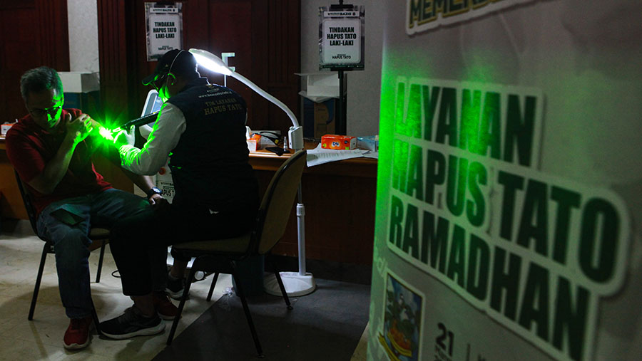 Petugas menghapus tato menggunakan laser di Kantor Wali Kota Jakarta Selatan, Jakarta, Kamis (21/3/2024). (Bloomberg Technoz/Andrean Kristianto)