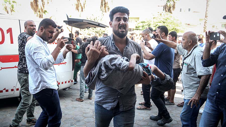 Seorang anak yang terluka tiba di Rumah Sakit usai serangan Israel di sekolah Rufaida al-Aslamia, Gaza, Kamis (10/10/2024). (Ahmad Salem/Bloomberg)
