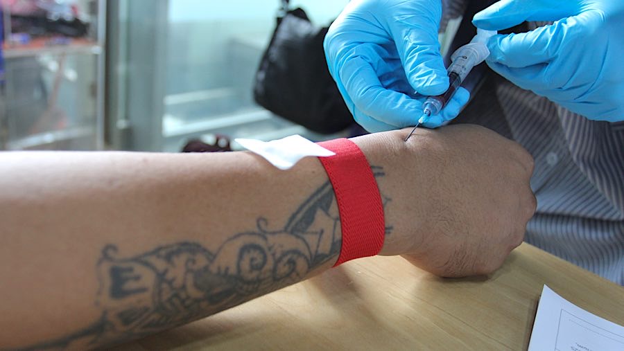 Petugas menyuntik peserta sebelum melakukan hapus tato di Balai Kota DKI Jakarta, Selasa (11/3/2025). (Bloomberg Technoz/Andrean Kristianto)