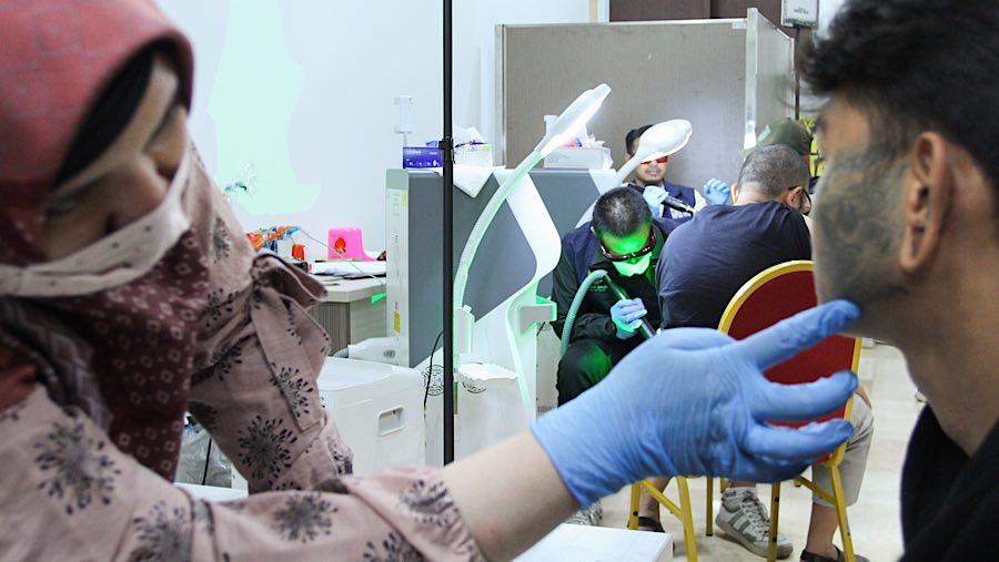 Baznas menyediakan layanan penghapusan tato gratis selama bulan Ramadhan 1446 Hijriah. (Bloomberg Technoz/Andrean Kristianto)