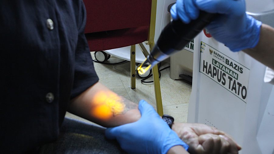 Program ini diharapkan dapat memberikan manfaat bagi masyarakat yang ingin menghapus tato mereka secara gratis. (Bloomberg Technoz/Andrean Kristianto)