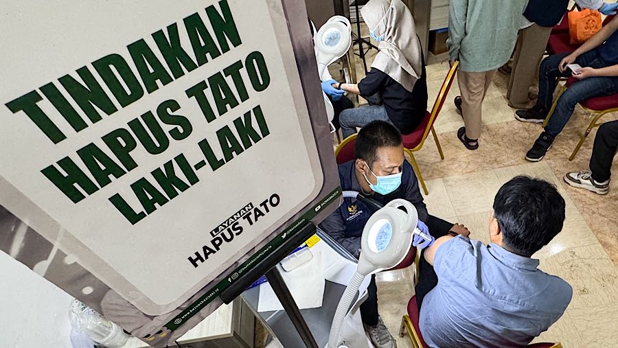 Layanan hapus tato akan dilakukan dibeberapa wilayah di Jakarta hingga 21 Maret 2025. (Bloomberg Technoz/Andrean Kristianto)