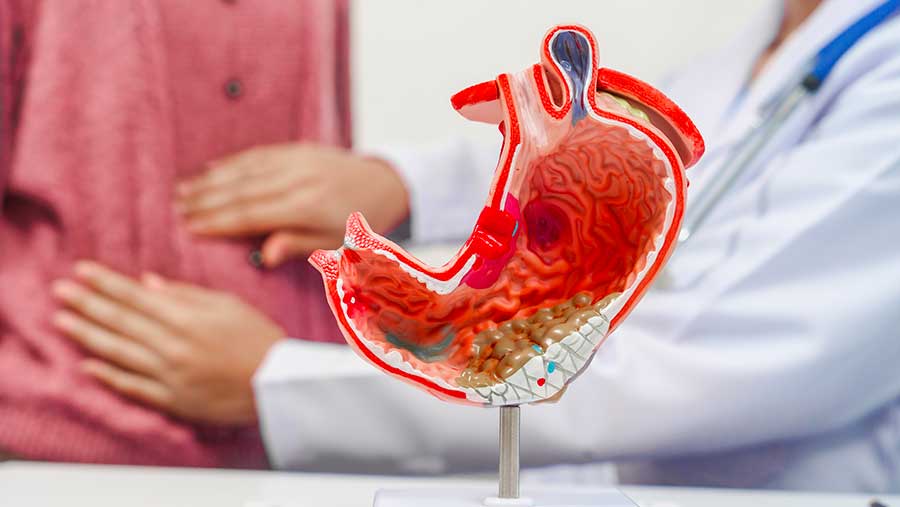 Ilustrasi cacing perut (Envato)