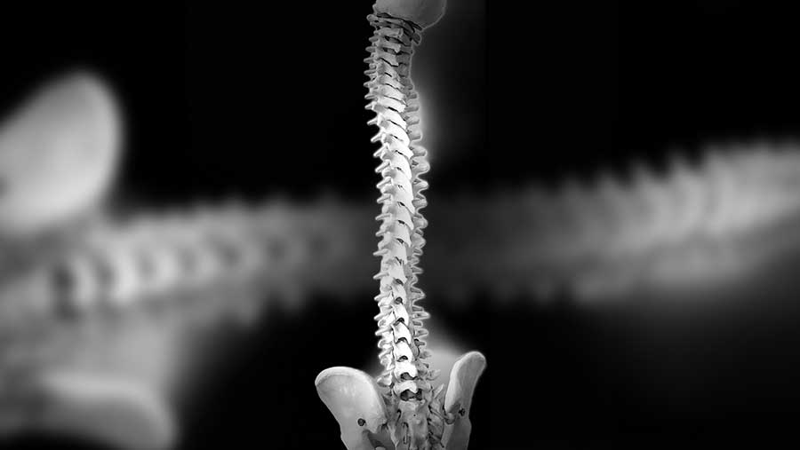 Ilustrasi Tulang Belakang (Envato)