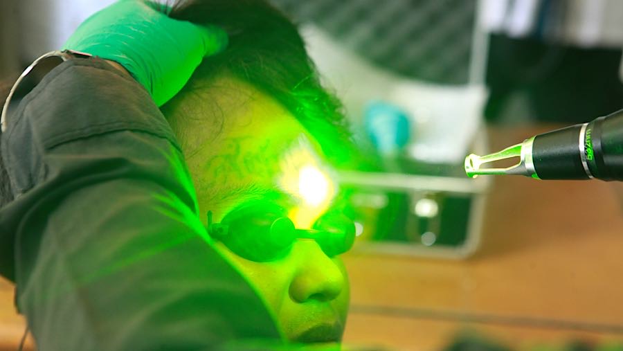 Baznas Provinsi DKI Jakarta kembali menggelar program roadshow hapus tato selama bulan Ramadhan. (Bloomberg Technoz/Andrean Kristianto)