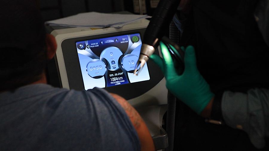 Kegiatan hapus tato ini bertujuan memberikan kesempatan kepada masyarakat yang ingin berhijrah dan memperbaiki diri  (Bloomberg Technoz/Andrean K)