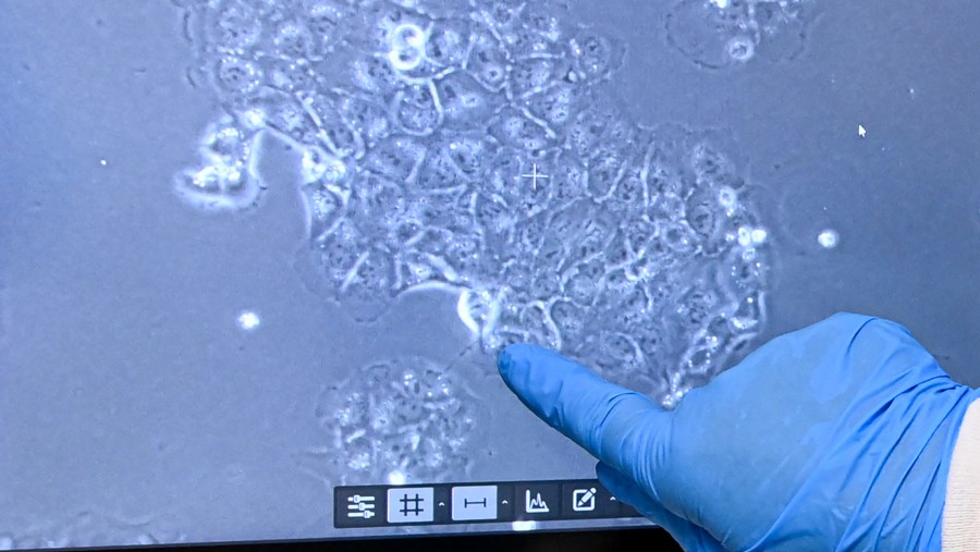 Penelitian berbasis model AI yang mampu meramal apakah seseorang berisiko kanker pankreas. Dok: bloomberg